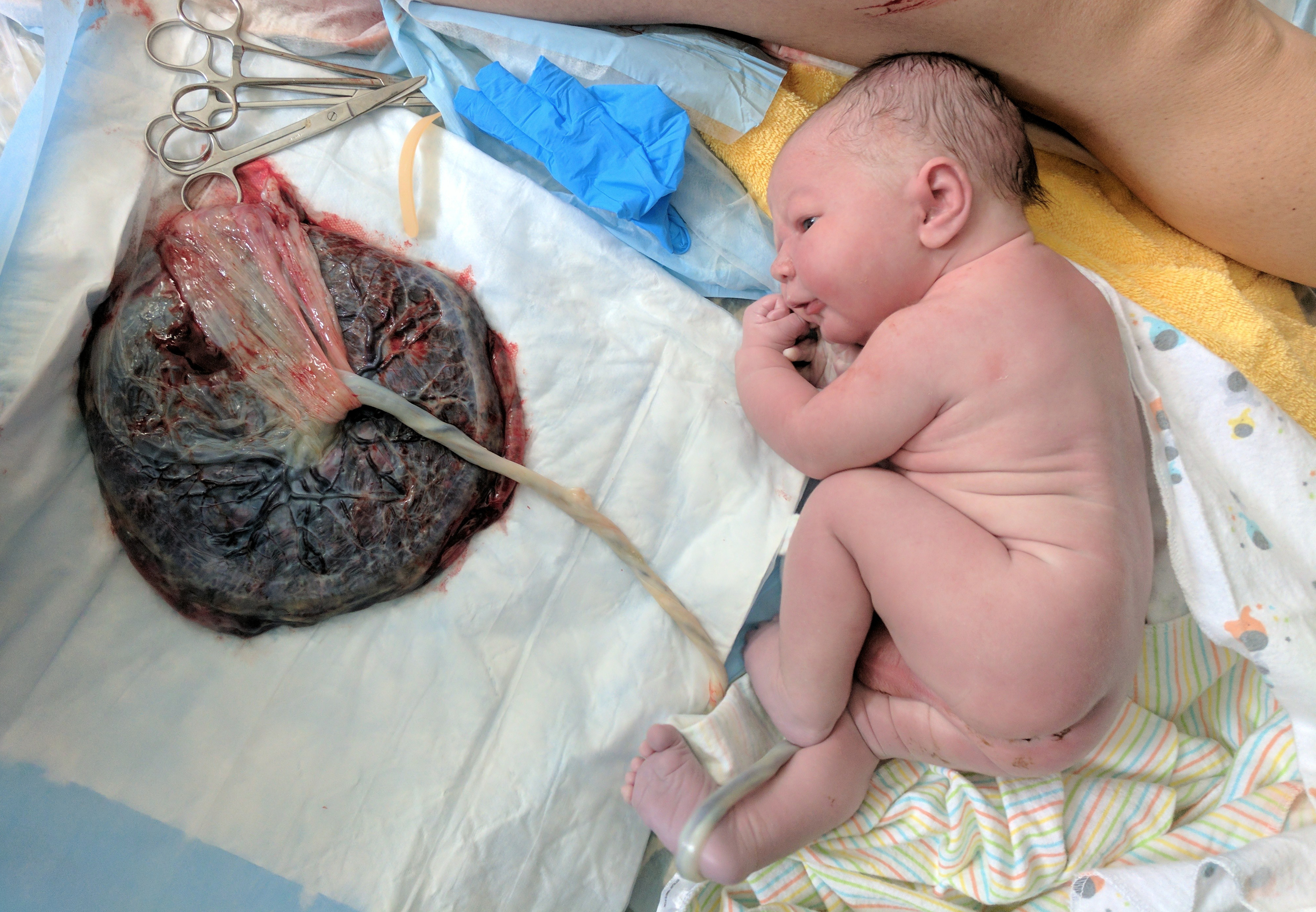 IMG_20170405_104023 (1)