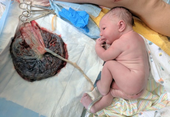 IMG_20170405_104023 (1)